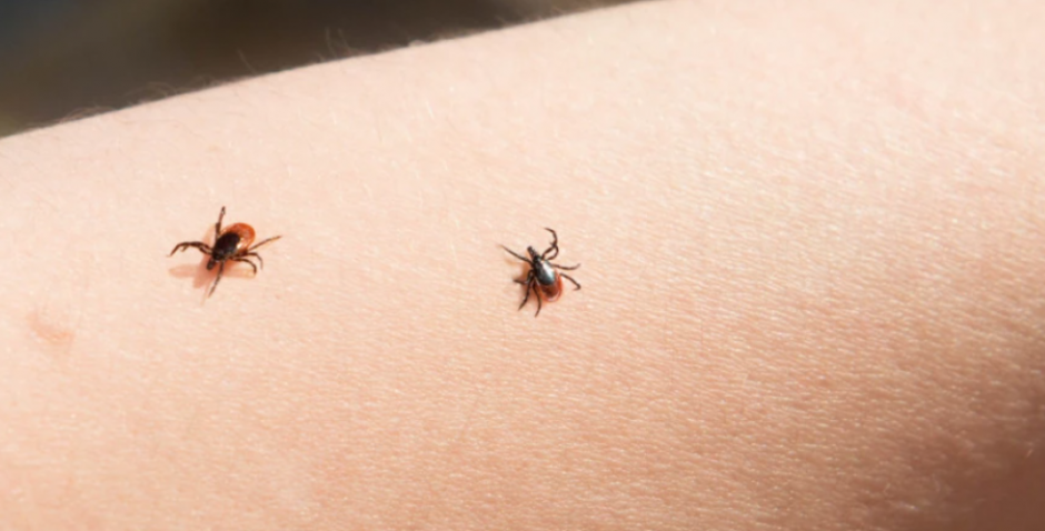 Evo šta nikako ne smete da radite ako vidite krpelja na koži